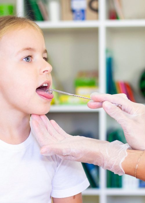 Speech therapy massage of the girl's tongue. a speech therapist makes a tongue massage to a child with a staging probe.